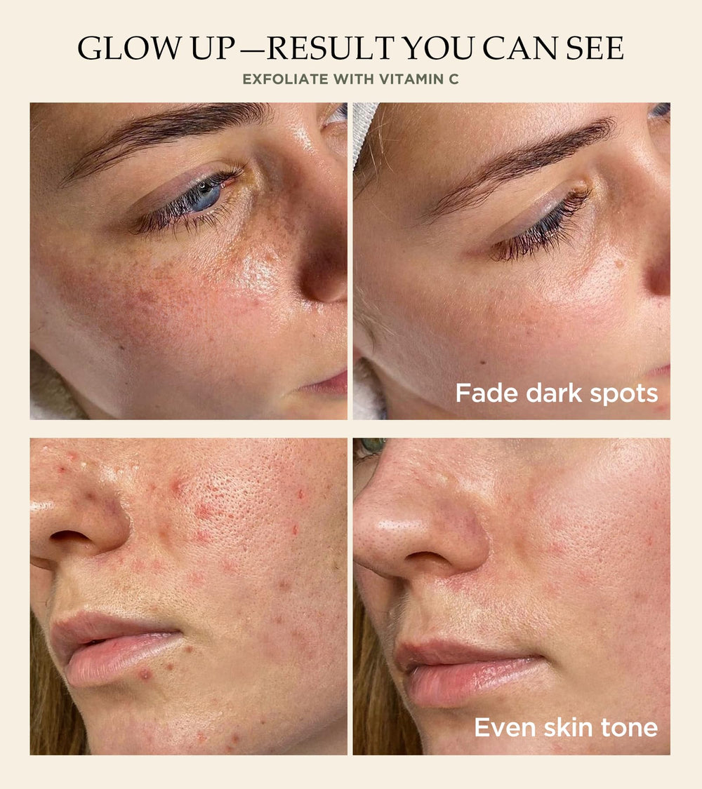 Srripo exfoliant visage sel marin purifiant en douceur.