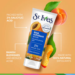 Acide salicylique 2% dans St. Ives : soutien potentiel des imperfections.