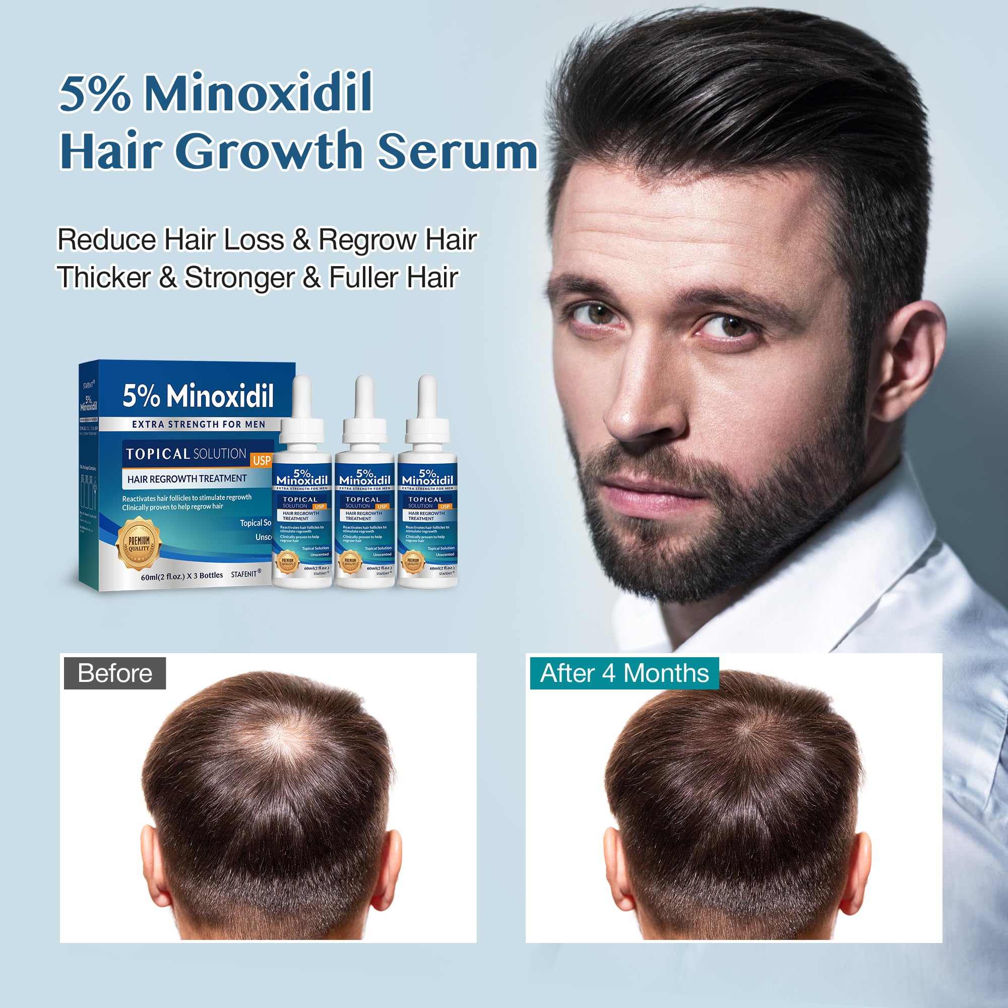 Régénération des cheveux sur cuir chevelu avec Stafenit.