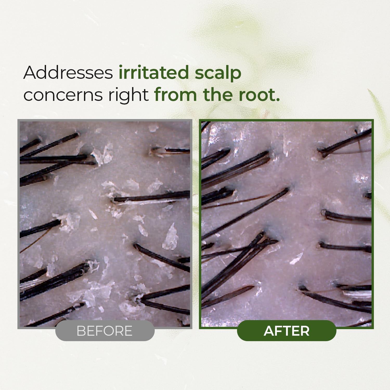 STEAMBASE Tea Tree Scalp Water Scaler, utilisation avant ou après shampoing pour un cuir chevelu net.