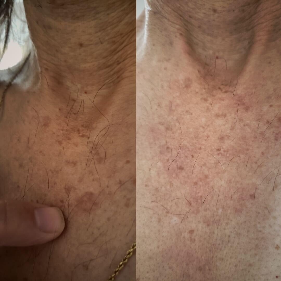 Stop Guessing BioFormula Select – sensation fraîcheur légère après lavage.