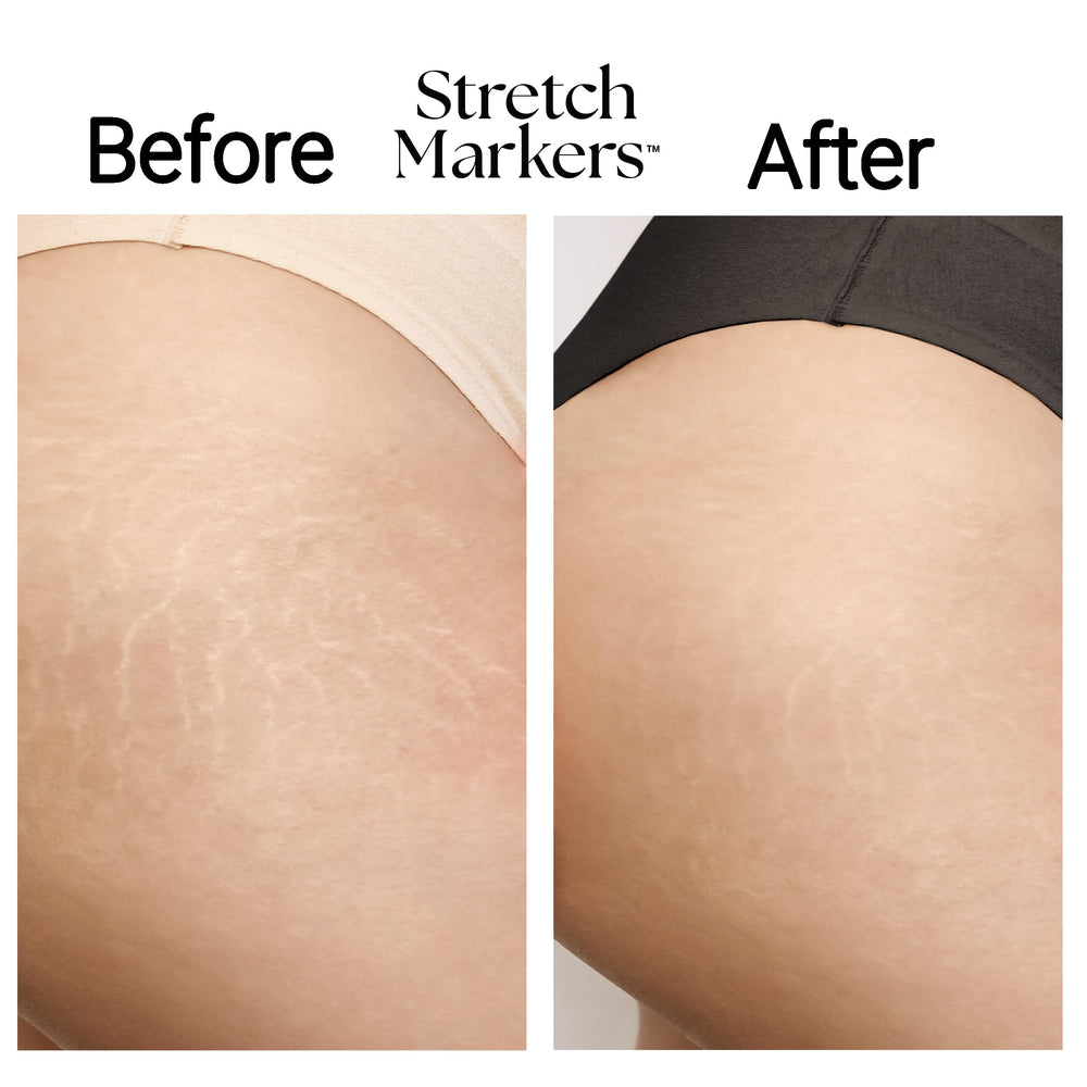 StretchMarkers Crème texture riche et veloutée, offre une sensation luxueuse et confortable.
