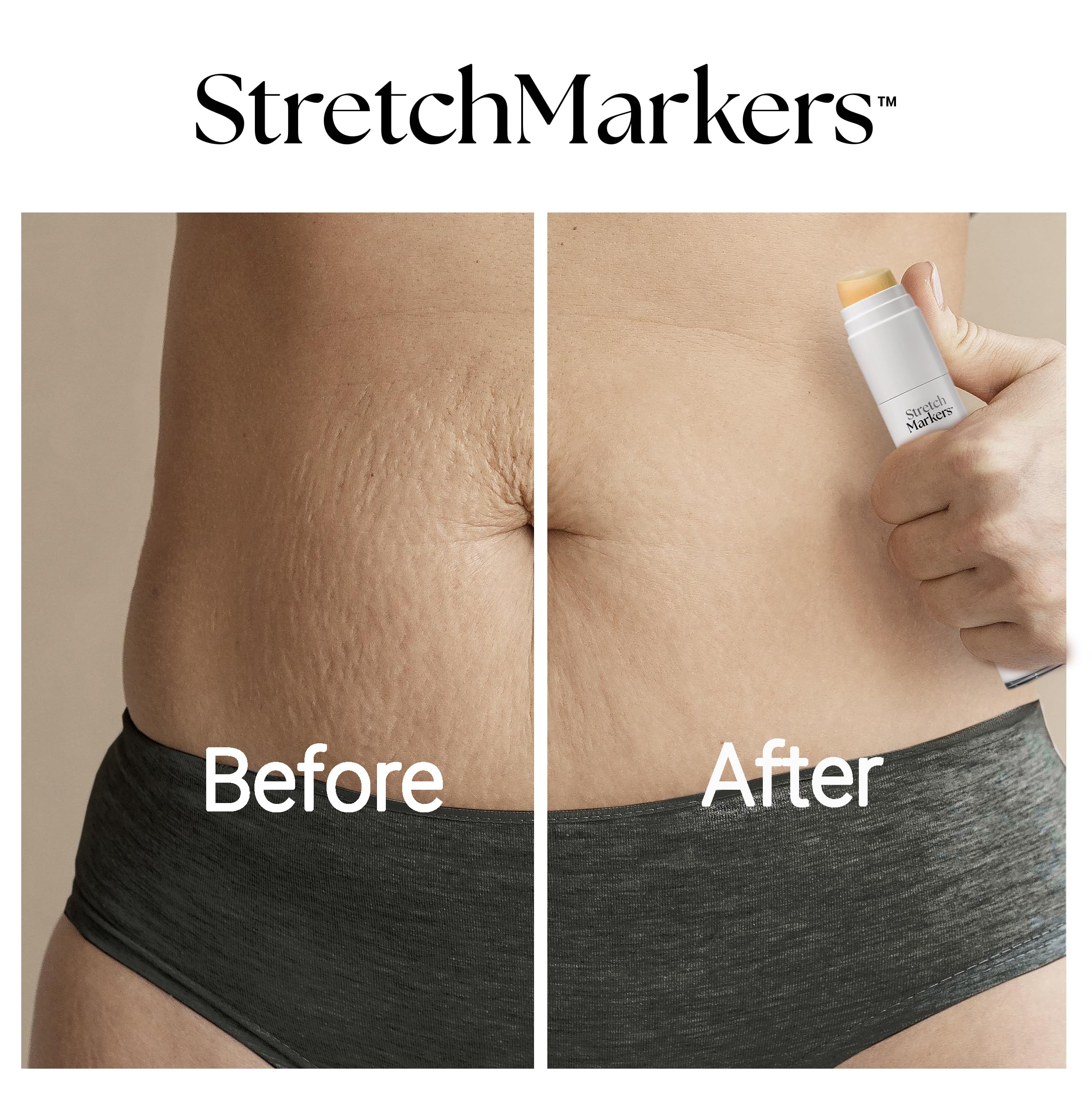 StretchMarkers Crème utilisation quotidienne, facile à intégrer dans une routine beauté.