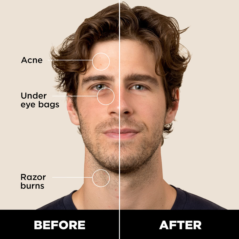 Mécanisme twist du bâton correcteur Stryx, dosage précis pour une couvrance légère.