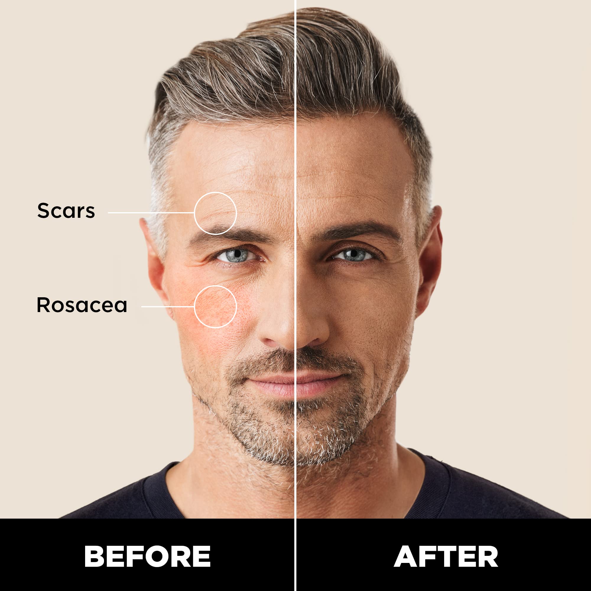 Stryx Concealer Tool démontrant une application sans résidu et naturelle.