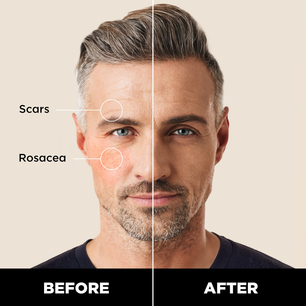 Stryx Concealer Tool démontrant une application sans résidu et naturelle.