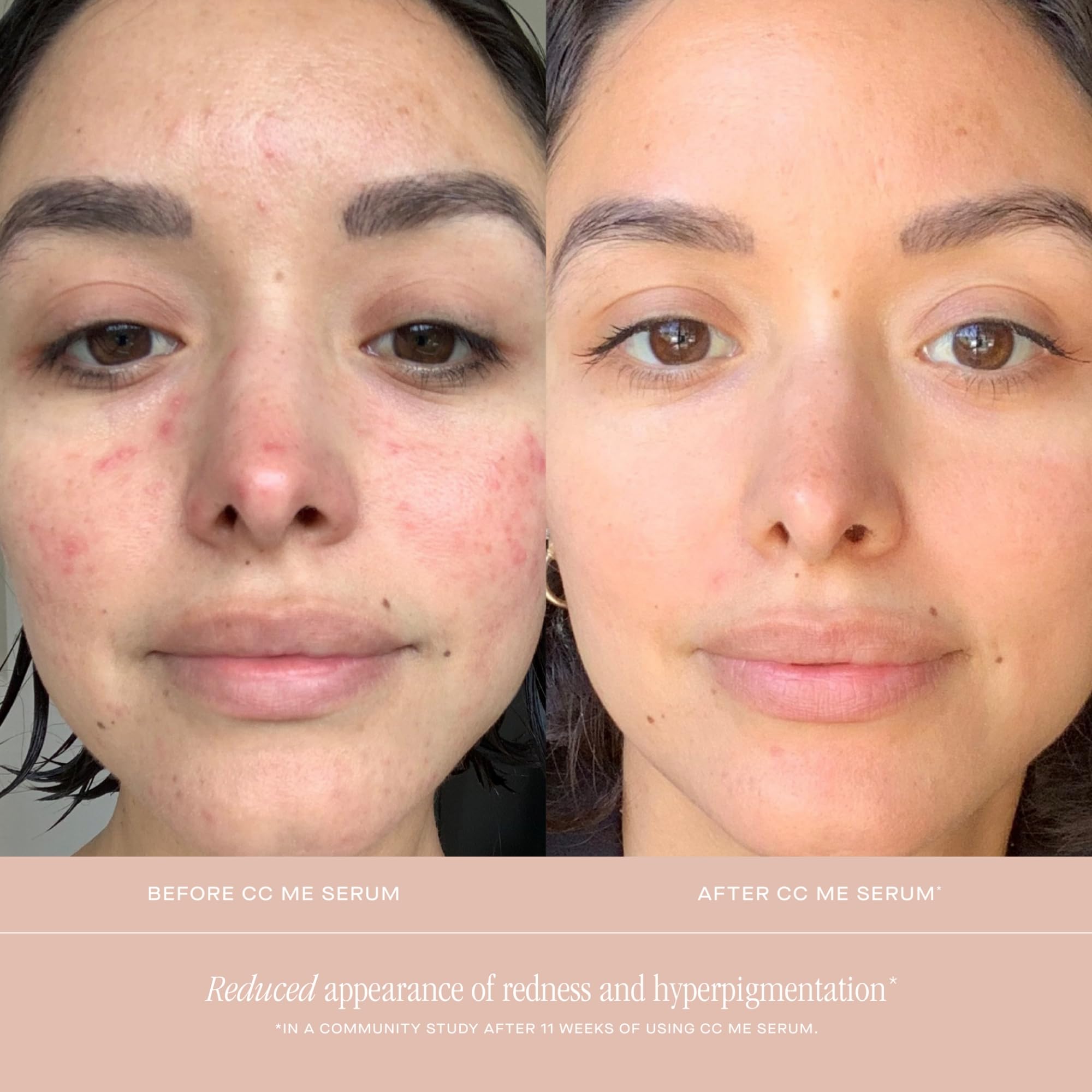 Rituel quotidien: appliquer le Summer Fridays CC Me Serum sur visage et cou.
