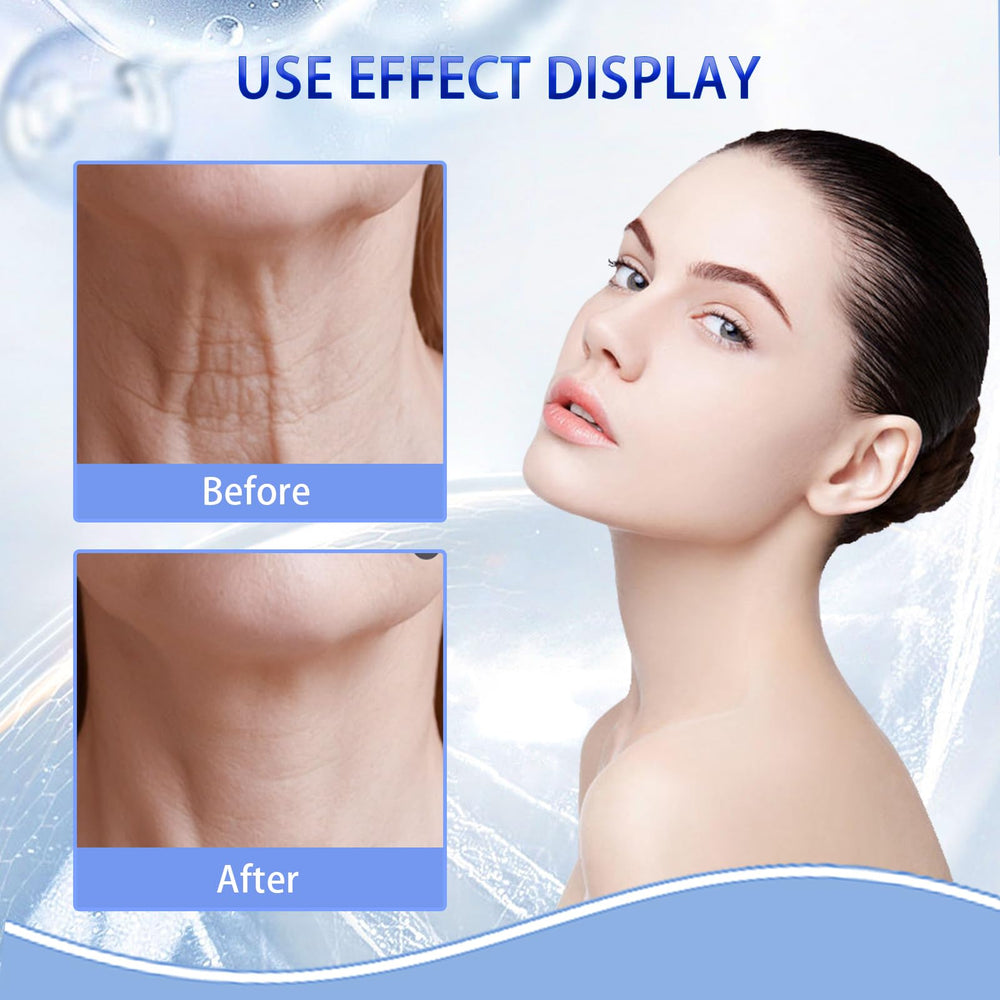 Sunnydeer contour visage définition menton – aide à raffermir les contours