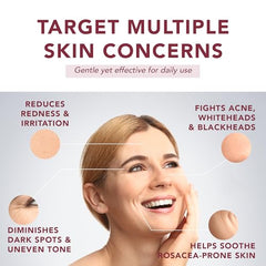 Suquato Serum azelaïque – réduit rougeurs légères et texture plus lisse.