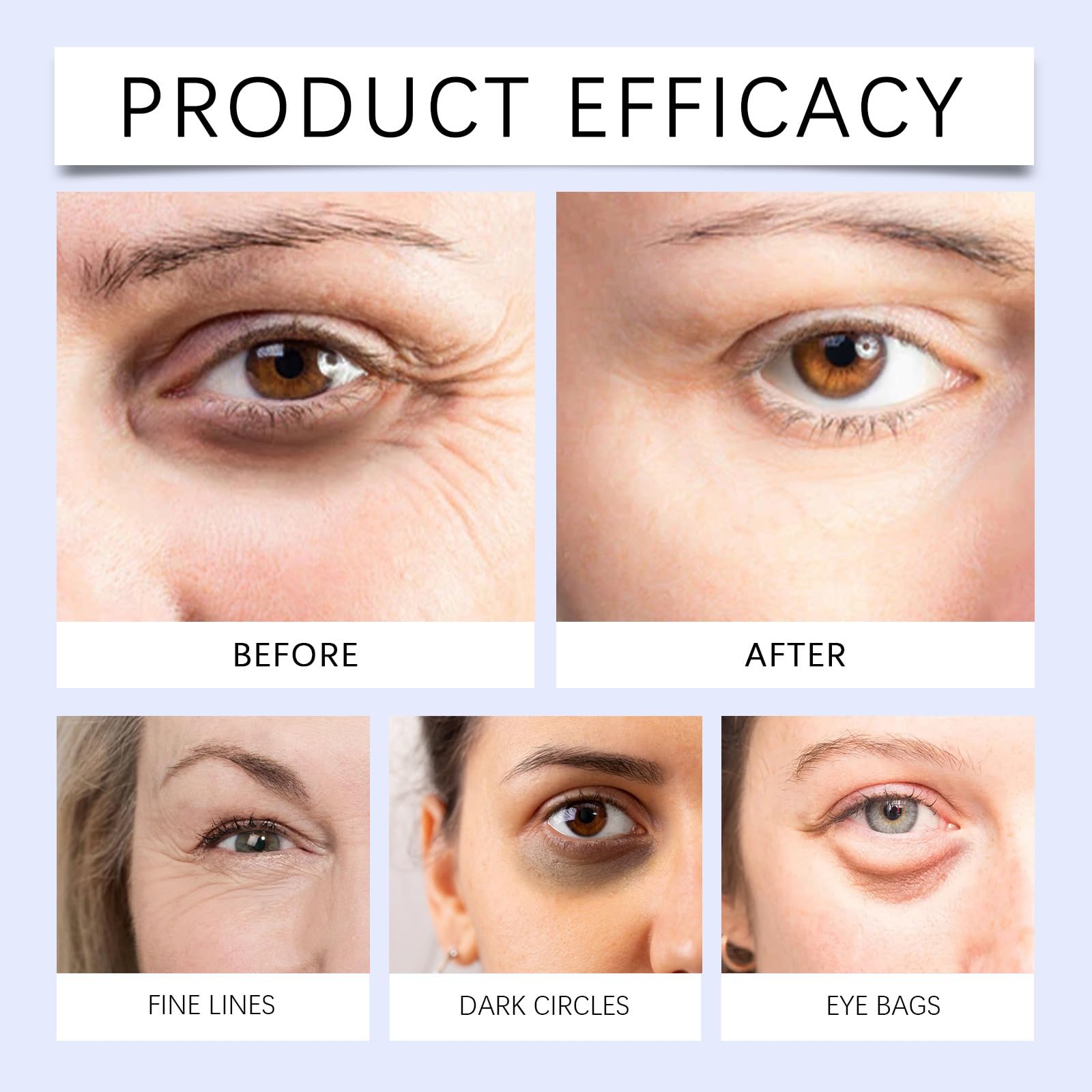 SURORAIN massage en cercles contour yeux pour confort quotidien