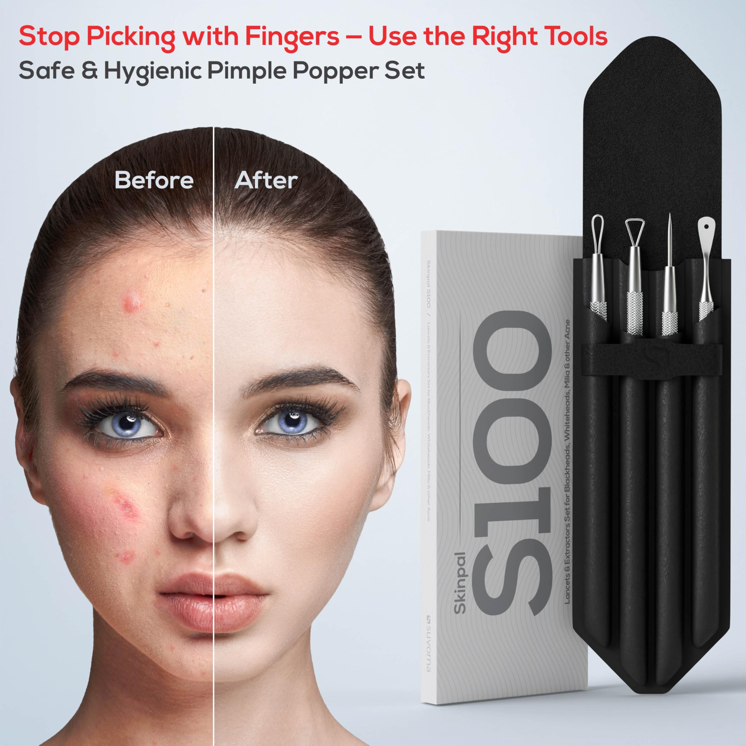 Extracteur de boutons Suvorna pour visage et peau nette