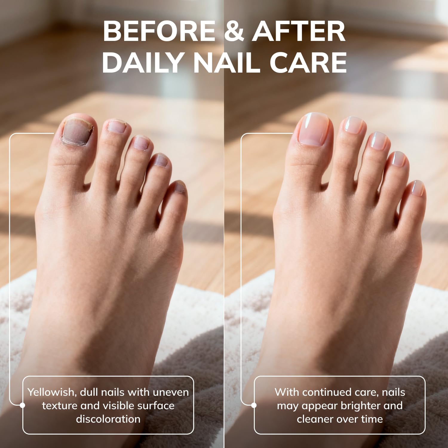 Soin pour ongles des mains et des pieds par Swissklip KlearNail.