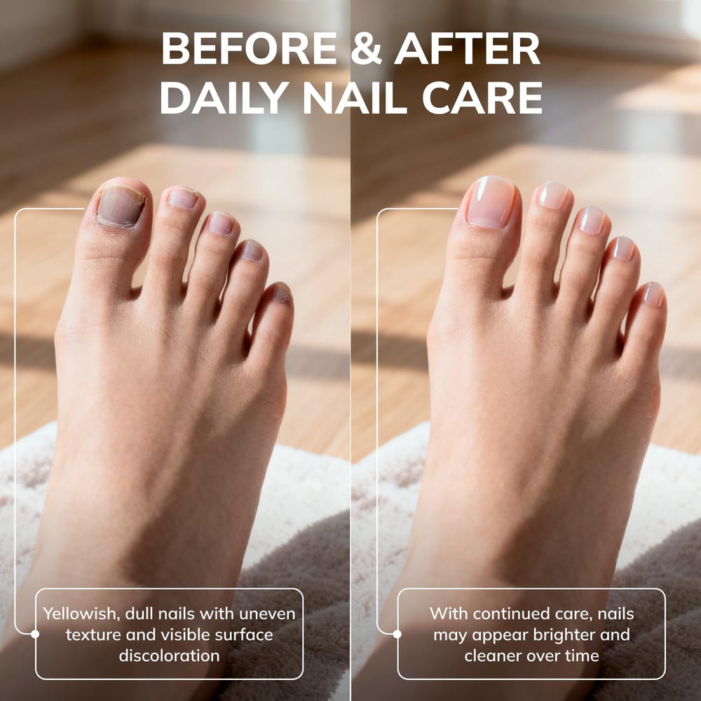 Soin pour ongles des mains et des pieds par Swissklip KlearNail.