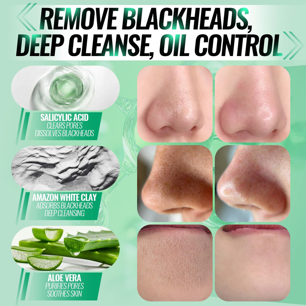 SYABO 2.0 acide salicylique: purifie les pores et régule le sébum.