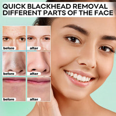 SYABO masque peel-off menton joues: action douce sur menton et joues.