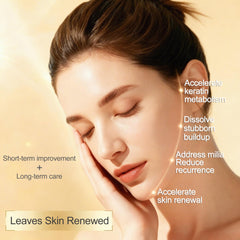 Sylvirene Milia Remover Serum used around the eyes for delicate spots