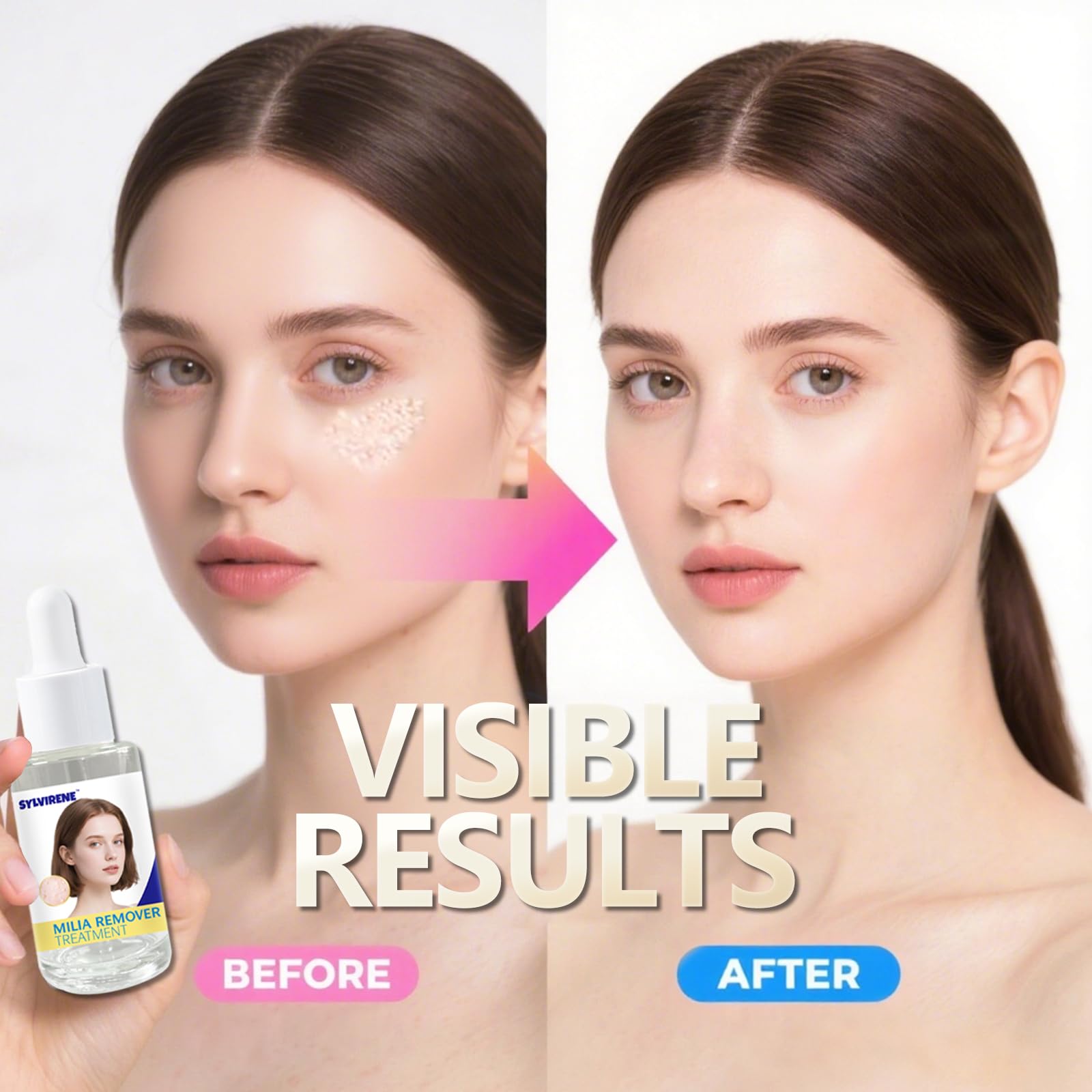 Sylvirene Milia Remover Serum for nasal area care close-up