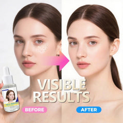 Sylvirene Milia Remover Serum for nasal area care close-up
