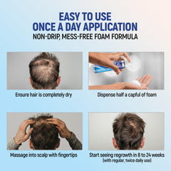 TARO Minoxidil: application quotidienne deux fois sur le cuir chevelu.