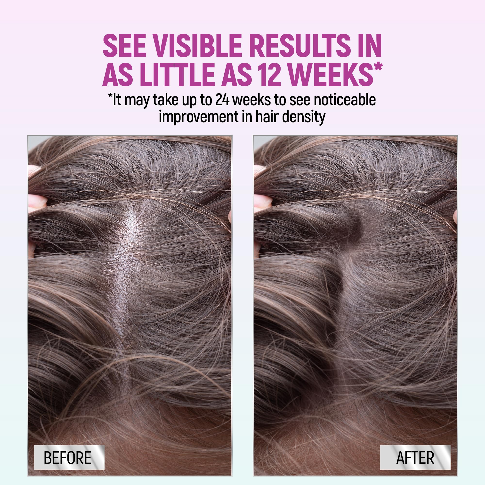 Utilisation quotidienne TARO Minoxidil: appliquez une fois par jour.