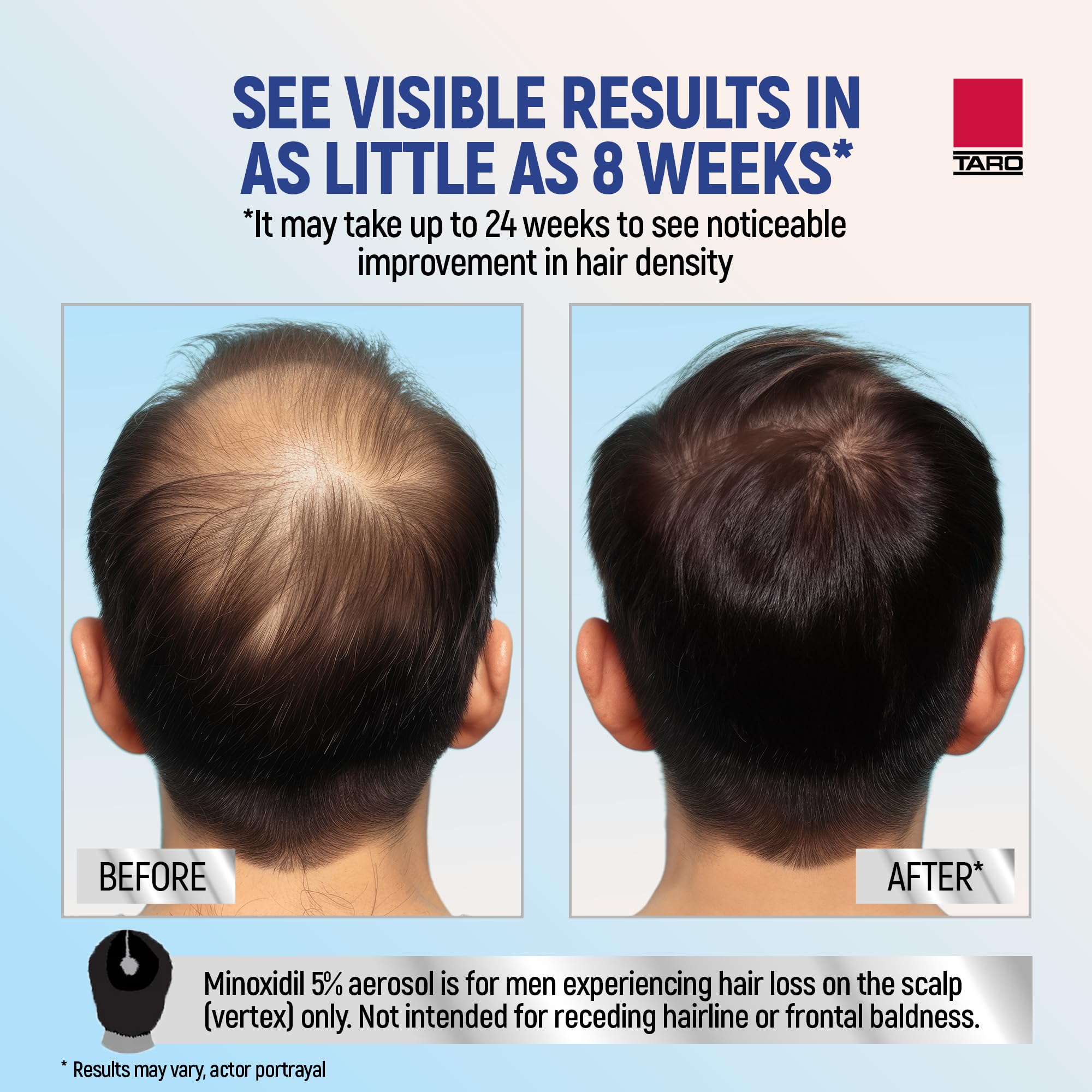 TARO Minoxidil Mousse Aérosol, séchage rapide après application.