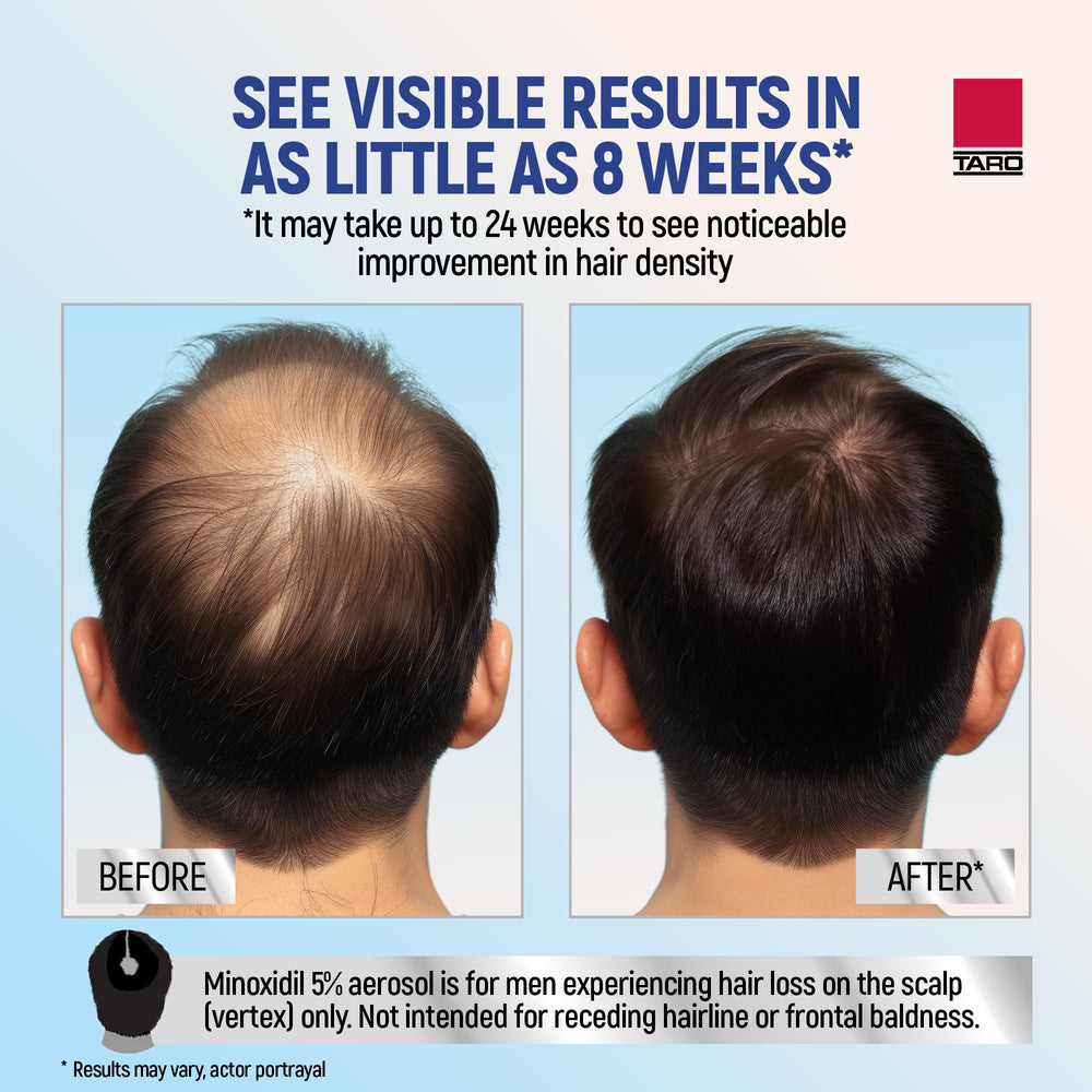 TARO Minoxidil Mousse Aérosol, séchage rapide après application.