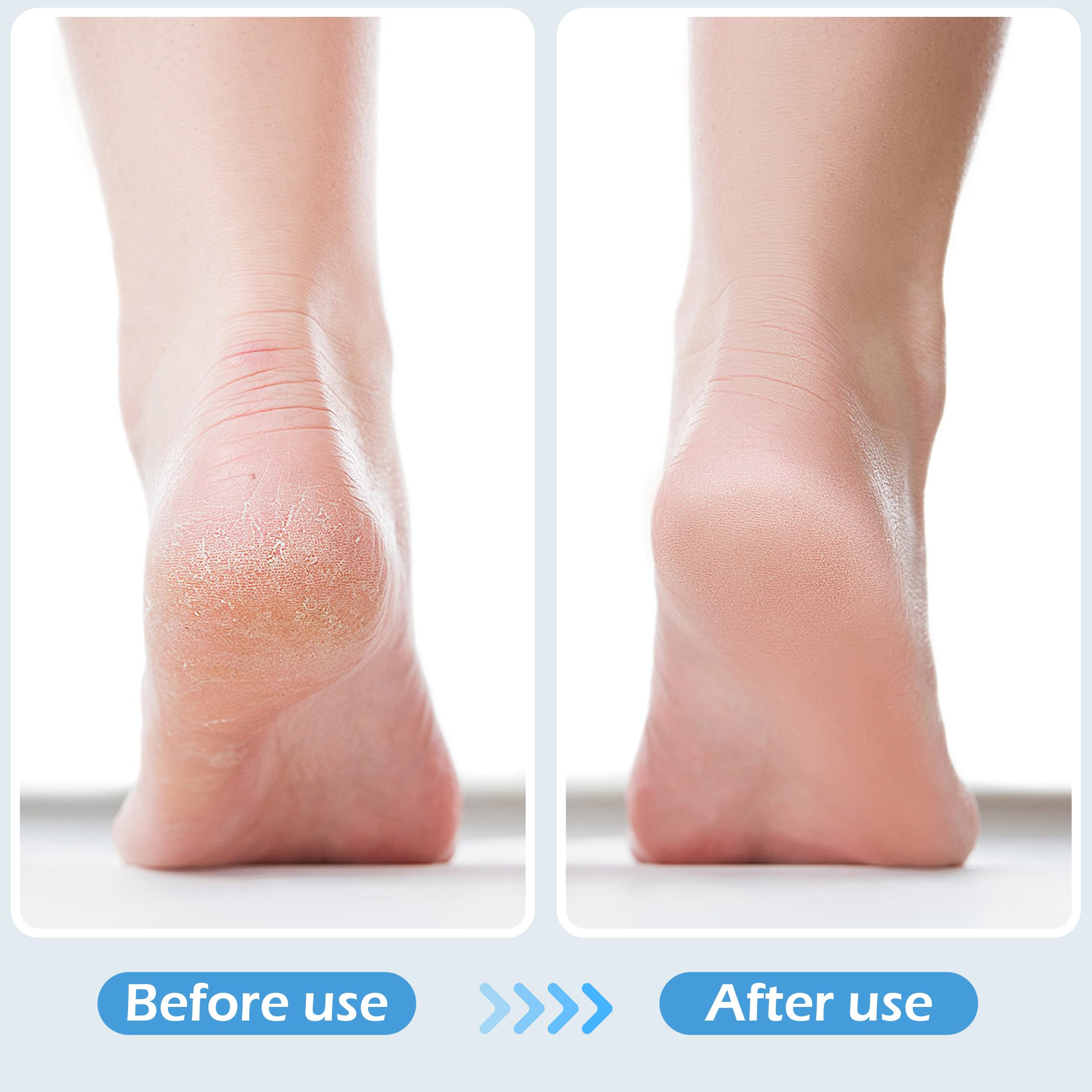 TaShow lime-pieds emery pour lisser les callosités.