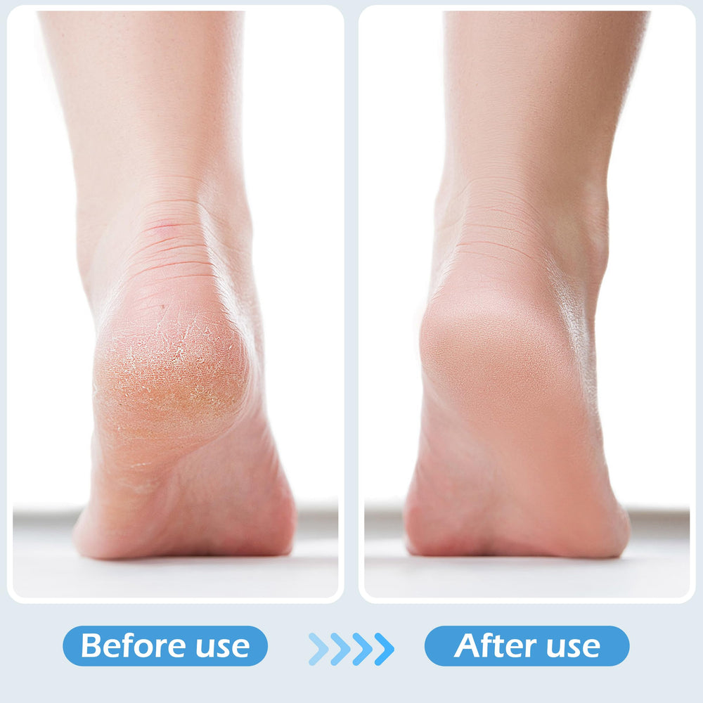TaShow lime-pieds emery pour lisser les callosités.