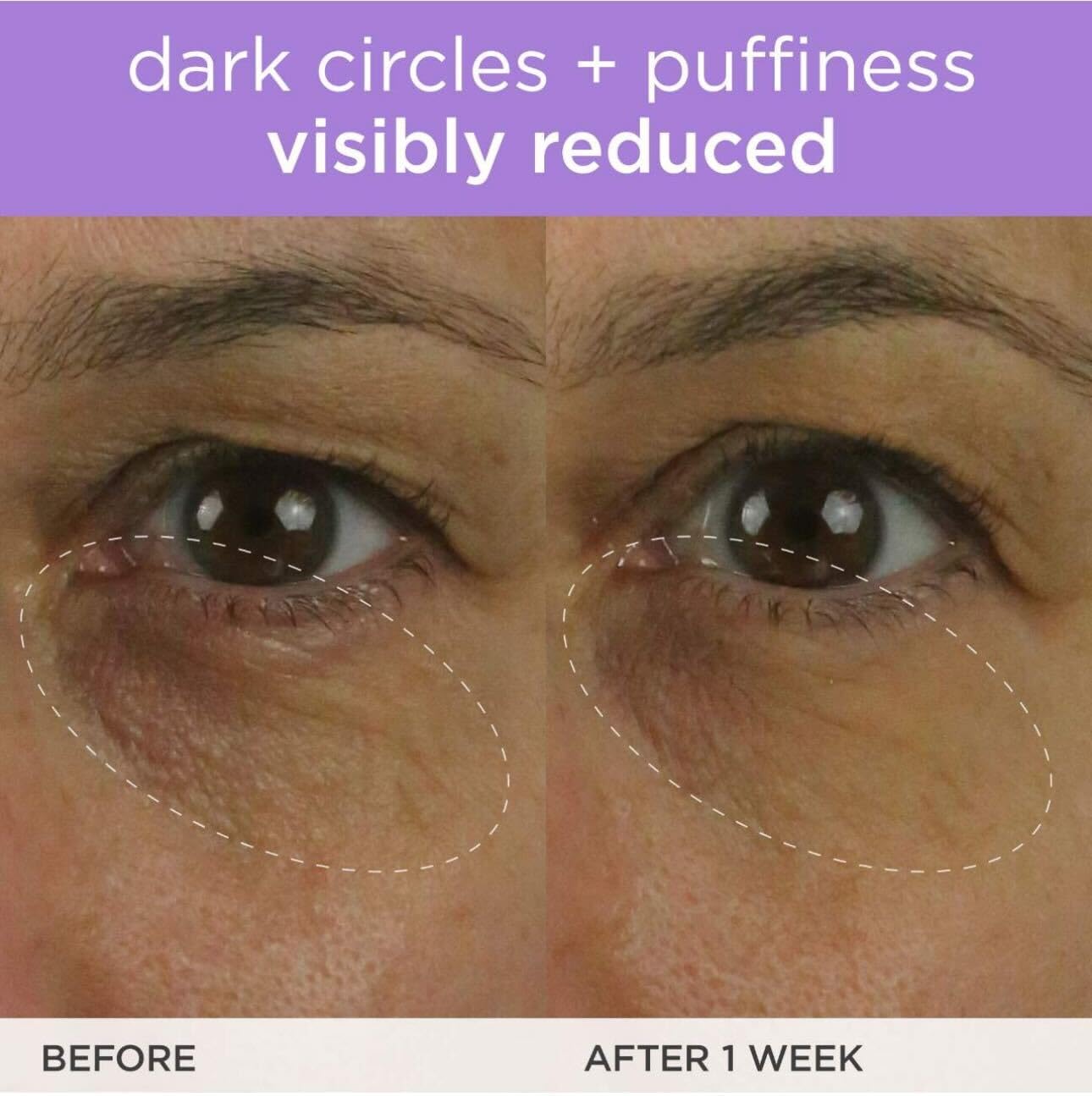 TATCHA Regard plus frais grâce à l’éclat léger autour des yeux.