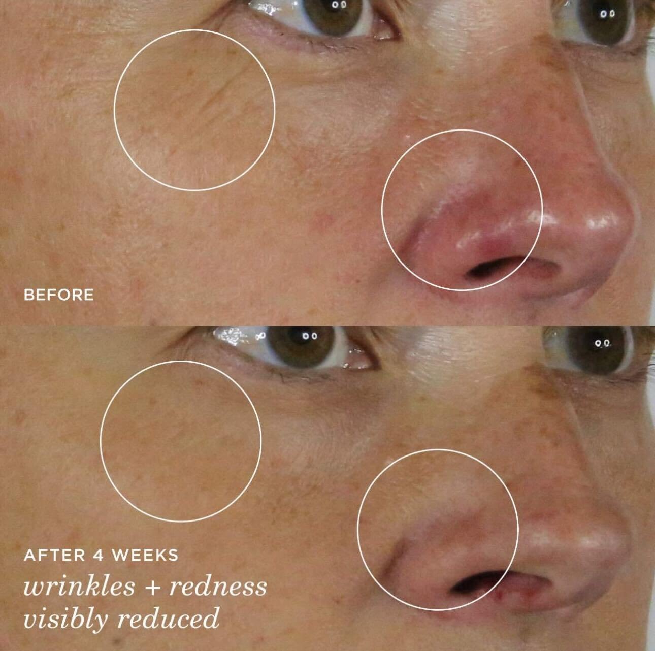 Sérum de soie Tatcha, apaisement des rougeurs et peau calme.