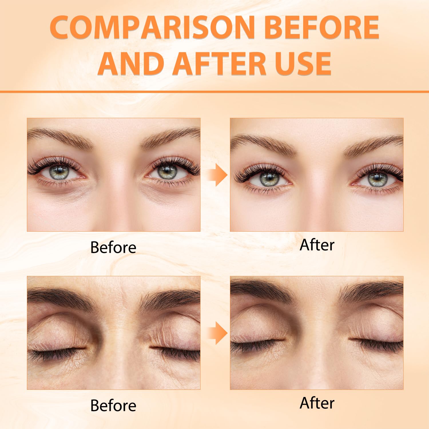 Tbexem Revive Glow zone poches yeux – peut réduire les poches