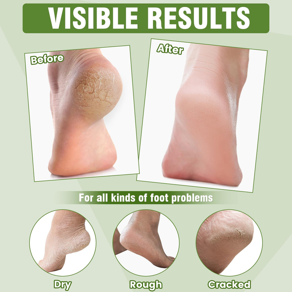 TEAWOO masque-pieds application rapide en 15 minutes pour soins à domicile.