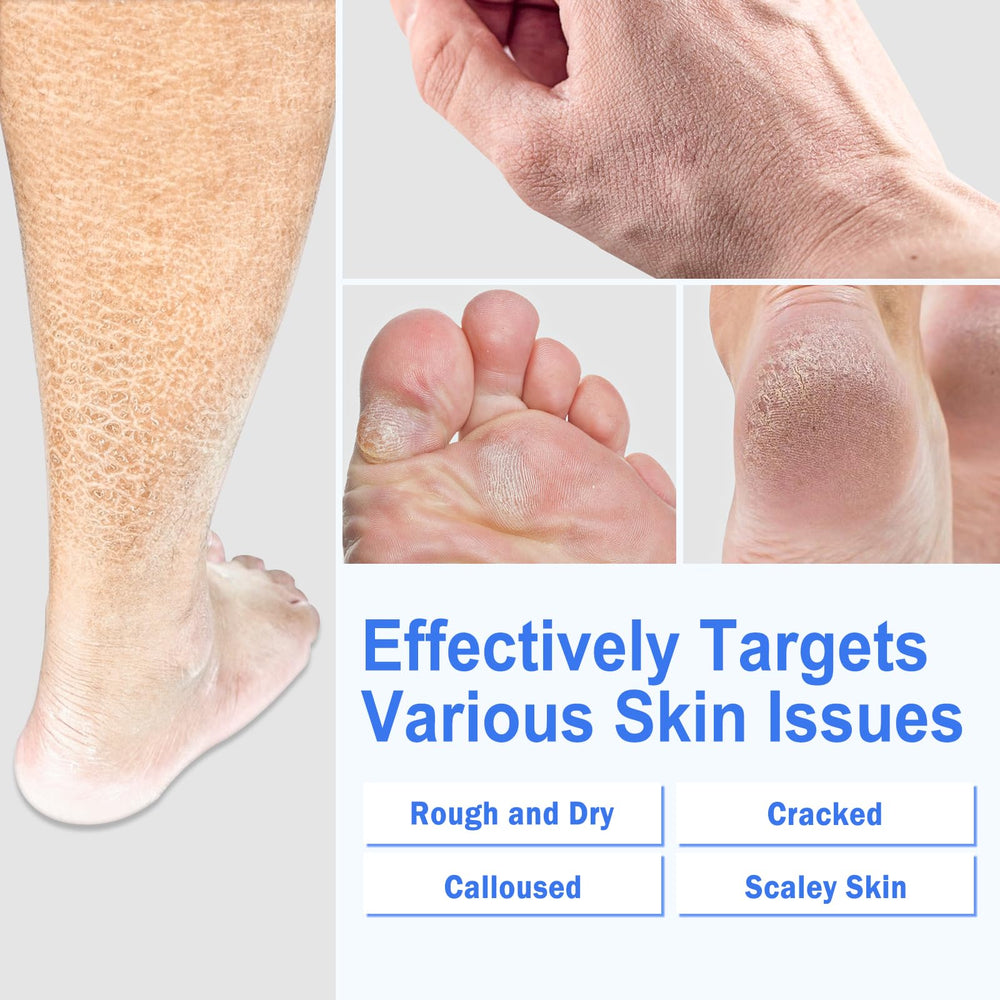 TEAWOO Crème Pieds - Application facilitée sur peau sèche.