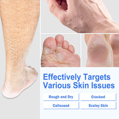 TEAWOO Crème Pieds - Application facilitée sur peau sèche.