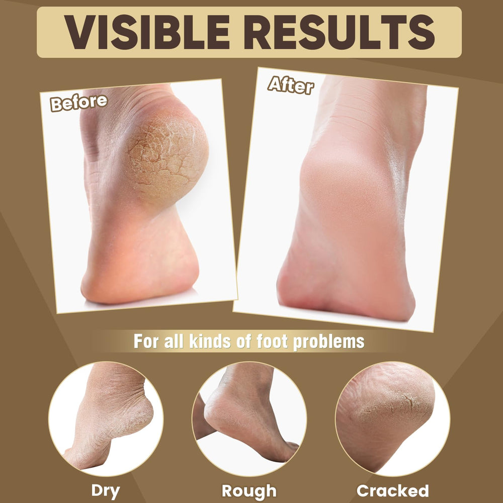 TEAWOO huile ricin jojoba, ingrédients nourrissants pour hydrater et assouplir les pieds