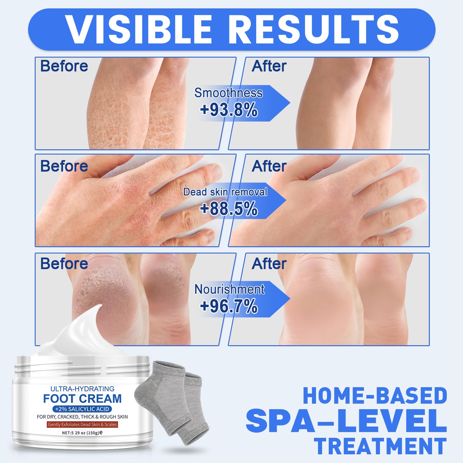 TEAWOO Crème Pieds - Hydratation rapide des talons secs.