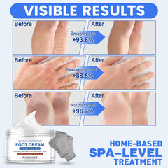 TEAWOO Crème Pieds - Hydratation rapide des talons secs.