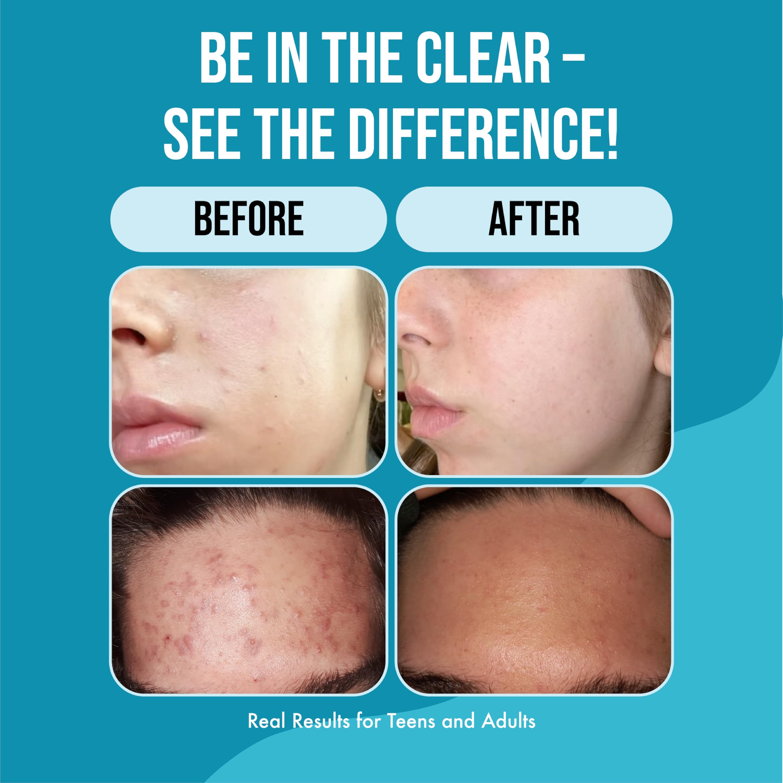 Shampoing Teenology Menthe – cuir chevelu apaisé et contrôle du sébum.