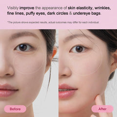 Patchs yeux caféine et niacinamide éclaircissent légèrement les cernes.
