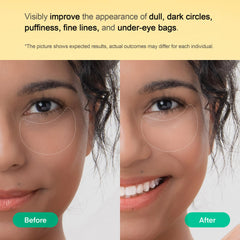 Patchs yeux TEREZ & HONOR riches en antioxydants bio nourrissant la peau