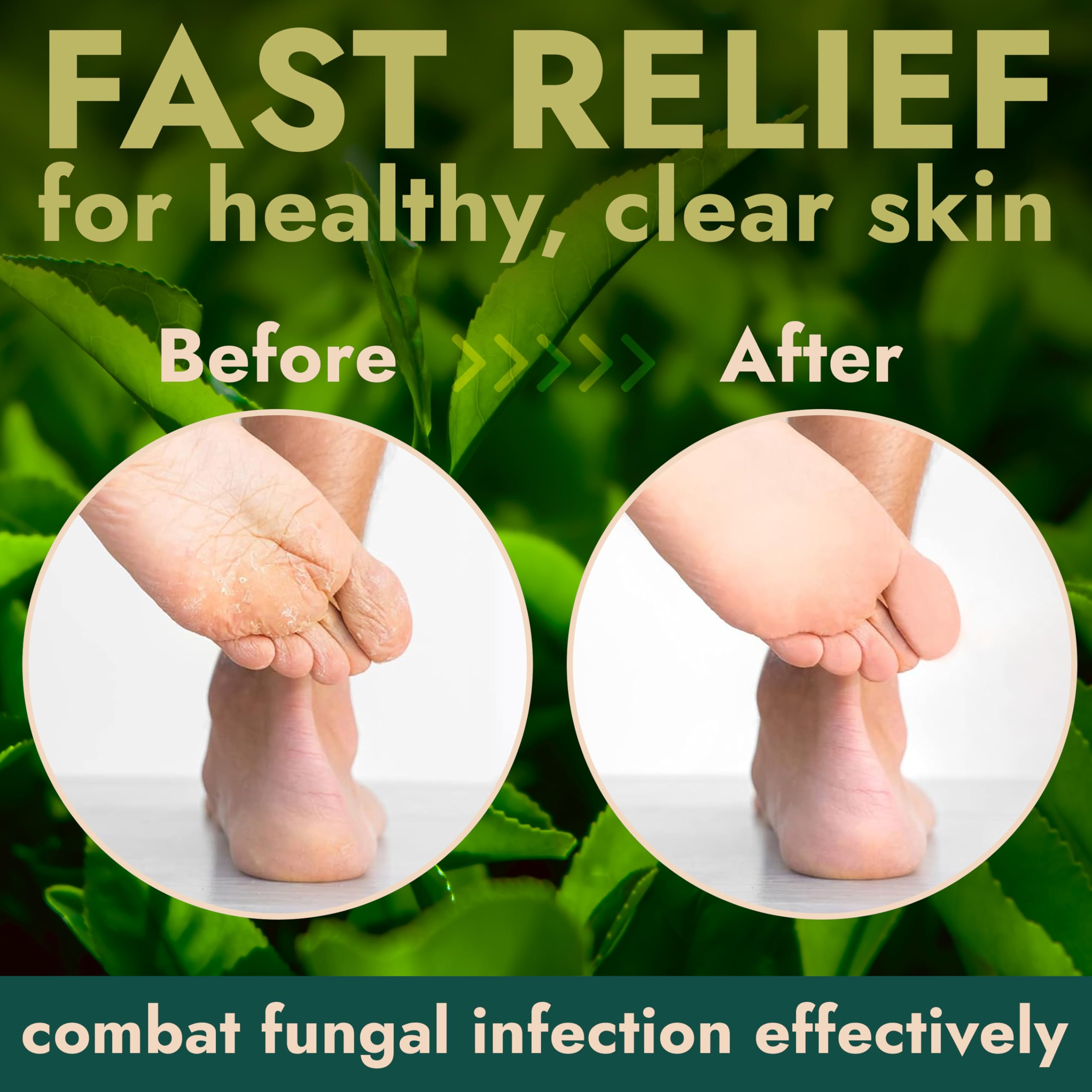 Terramed Just Think Comfort tea tree oil bottle highlighting antibacterial support for feet