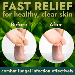 Terramed Just Think Comfort tea tree oil bottle highlighting antibacterial support for feet