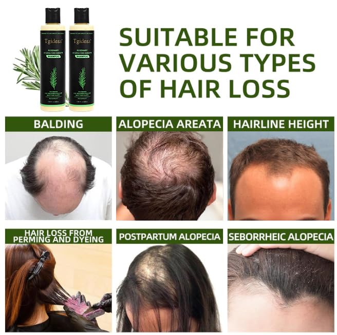 Tgideas Romarin – Ingrédients naturels: nourrissent le cuir chevelu et adoucissent les cheveux.