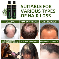 Tgideas Romarin – Ingrédients naturels: nourrissent le cuir chevelu et adoucissent les cheveux.