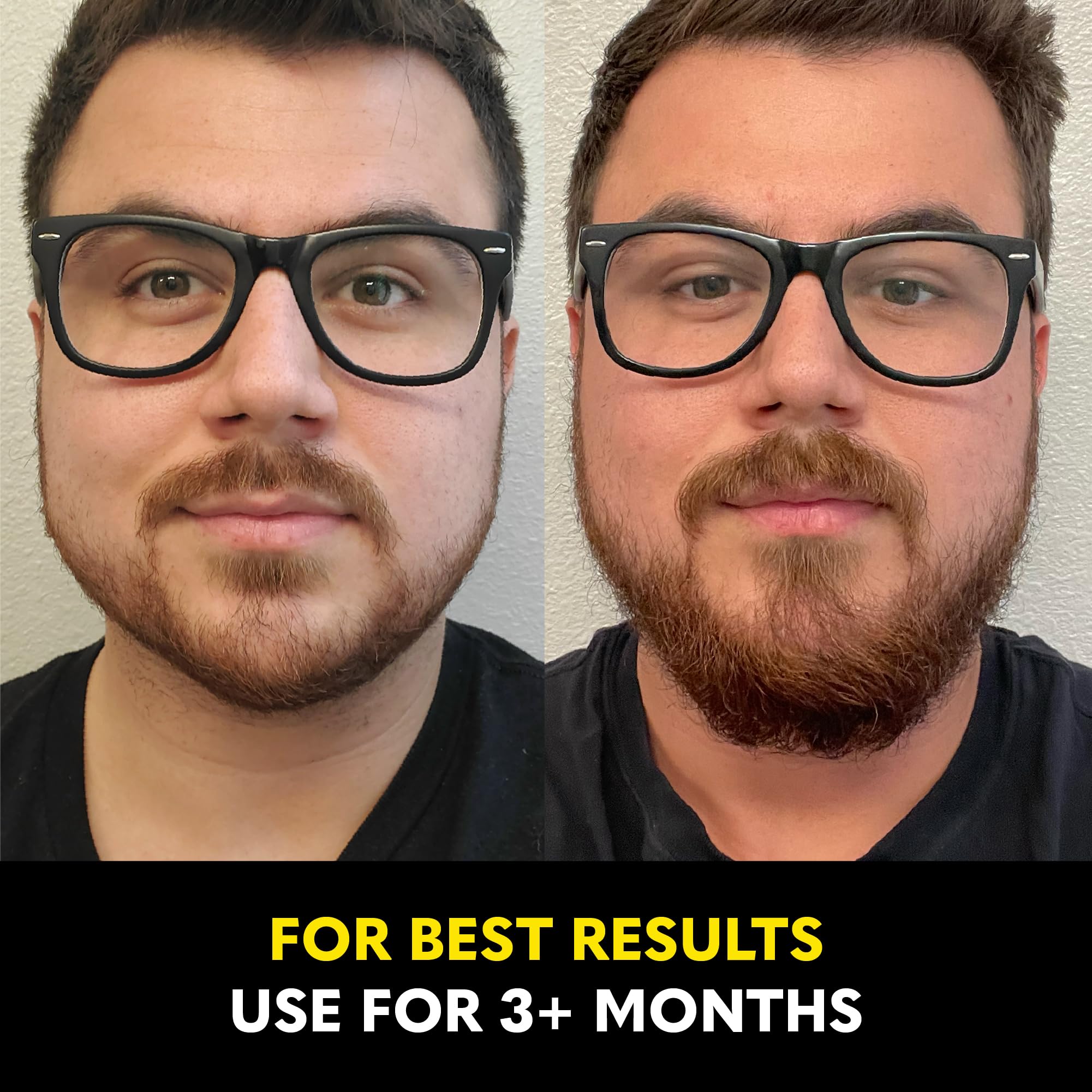 The Beard Club Biotin Spray Usage Quotidien: intégration facile dans la routine.