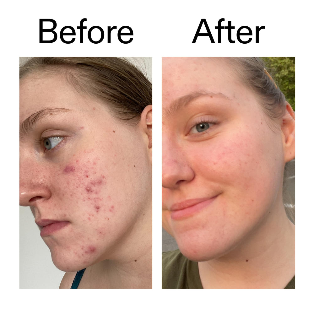 The INKEY List Toner 10% Glycolic : éclat quotidien du teint