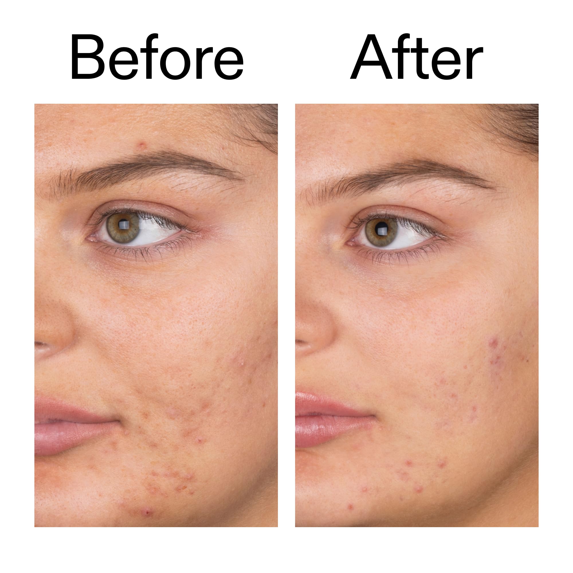 The INKEY List Salicylic Acid Cleanser for morning routine leaves skin refreshed.