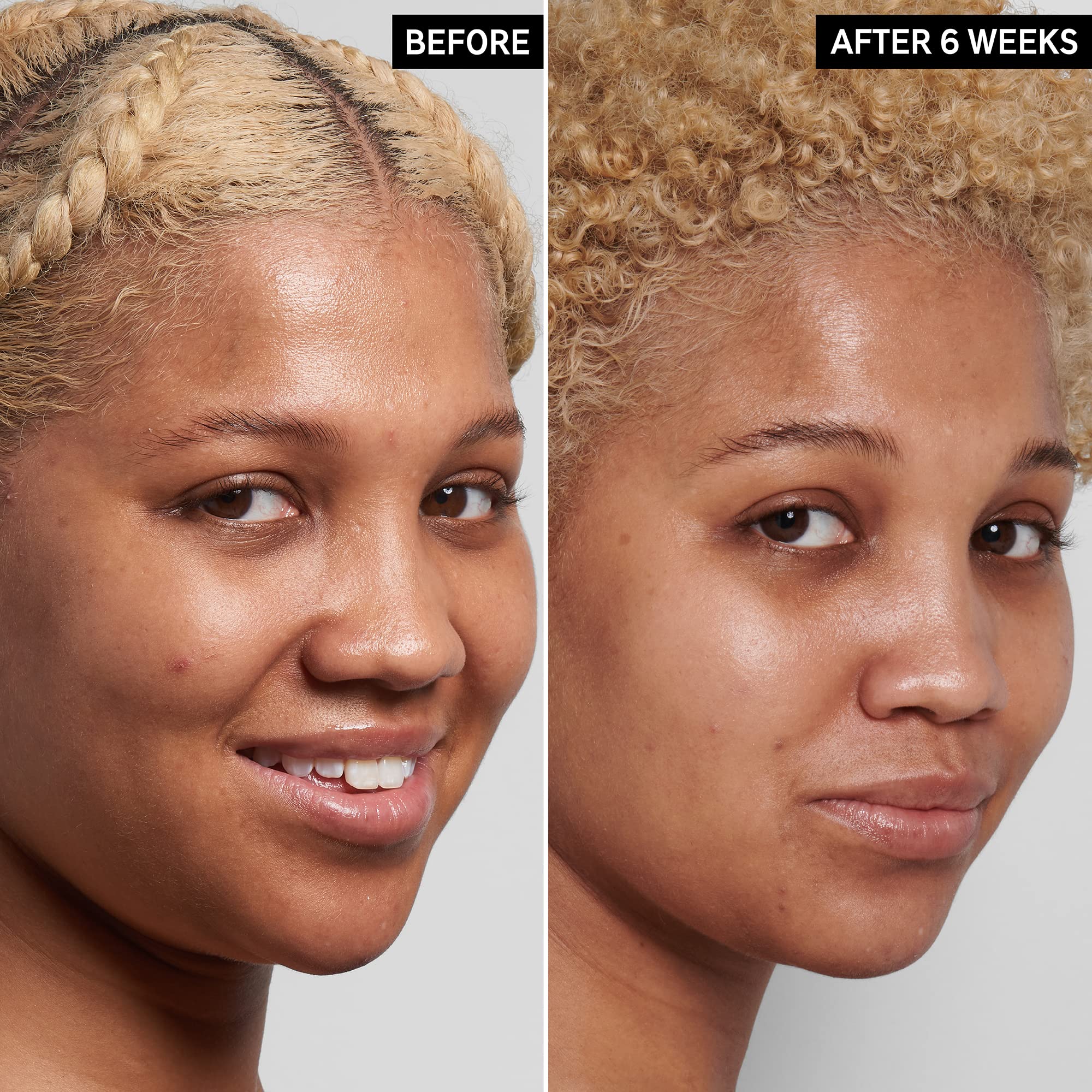 Texture légère et fluide du sérum Niacinamide 10% pour le visage.