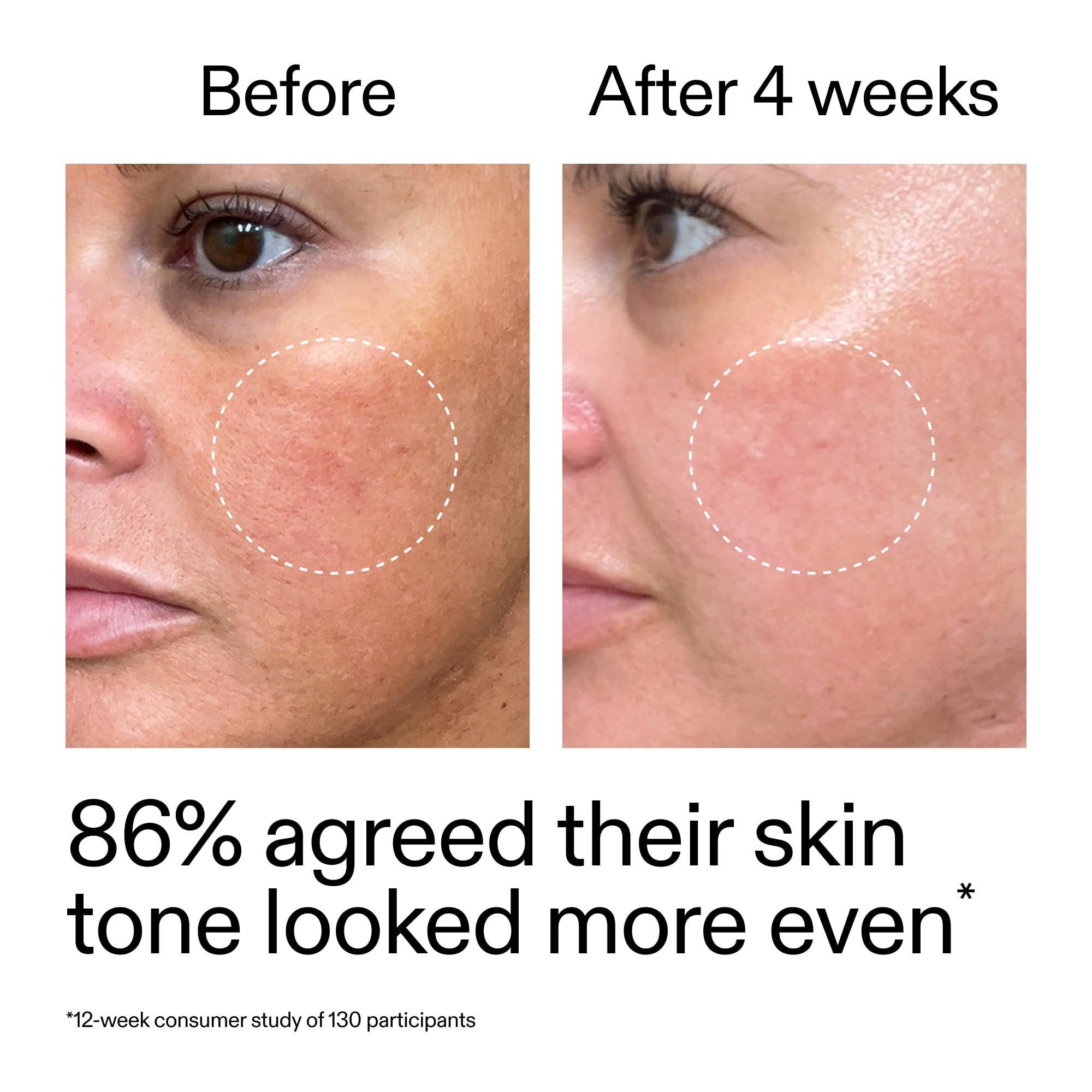 The INKEY List Starter Dual Retinol Serum — routine simple pour débutants et peau sensible.