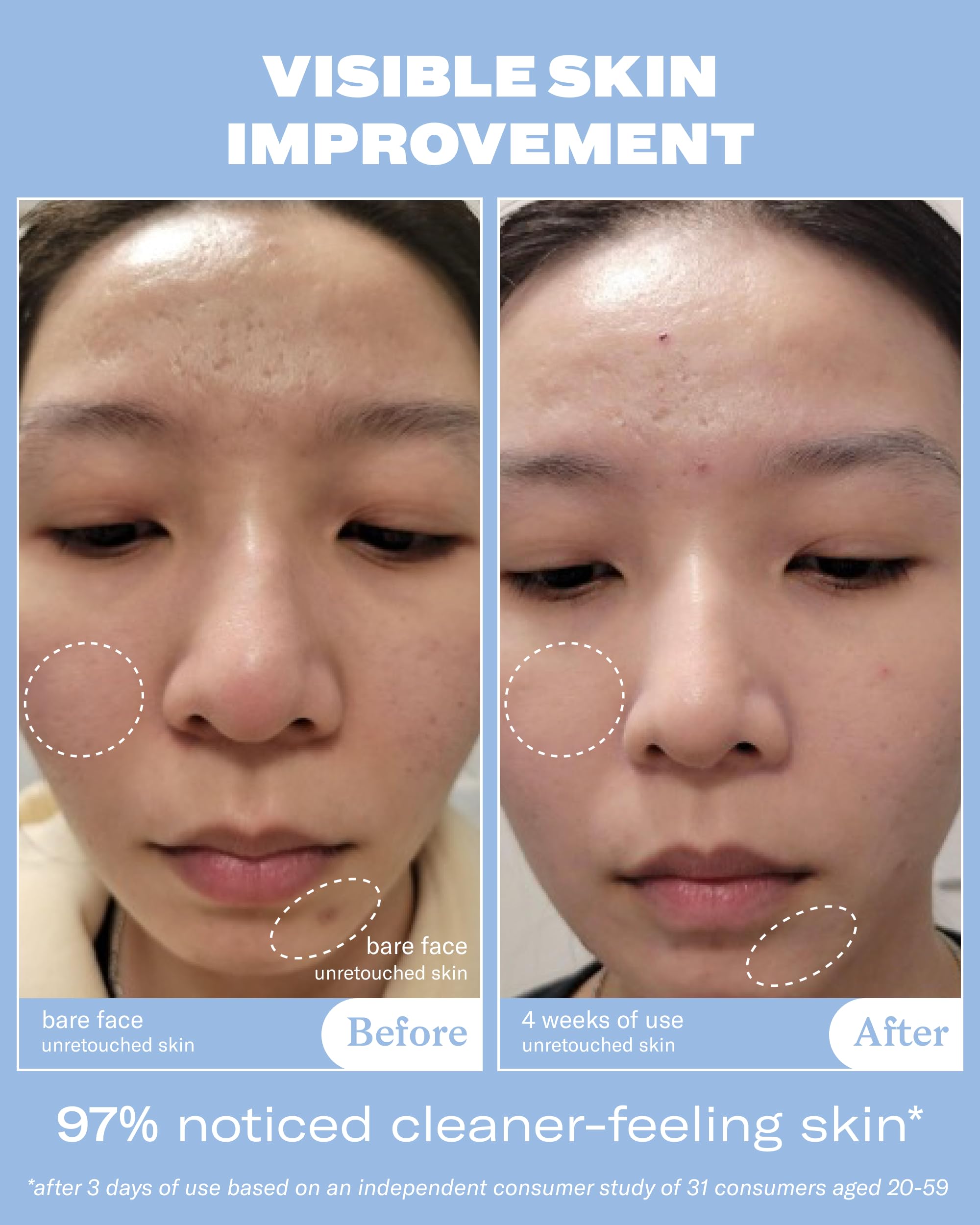 Then I Met You gel exfoliant végétal – texture soyeuse et action sur les pores